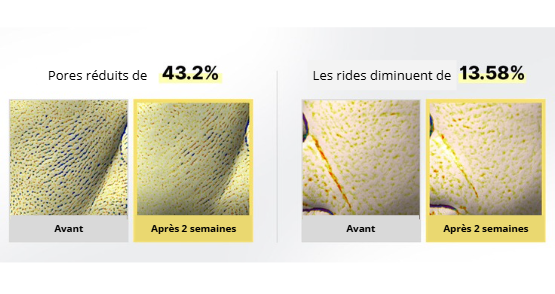 Booster raffermissant rétinal Vita-A - anti-âge et réparateur