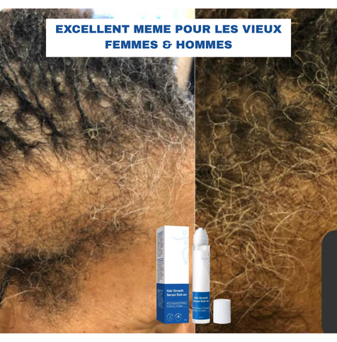 🌿 SÉRUM ROLL-ON CROISSANCE DE CHEVEUX – Homme&Femme🇺🇸 🇬🇦