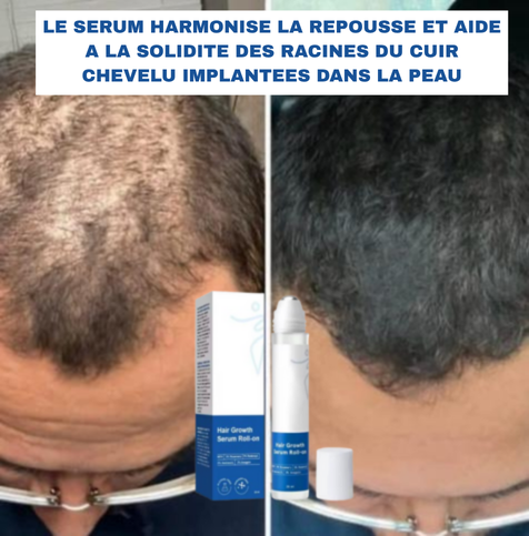 🌿 SÉRUM ROLL-ON CROISSANCE DE CHEVEUX – Homme&Femme🇺🇸 🇬🇦