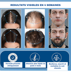 🌿 SÉRUM ROLL-ON CROISSANCE DE CHEVEUX – Homme&Femme🇺🇸 🇬🇦