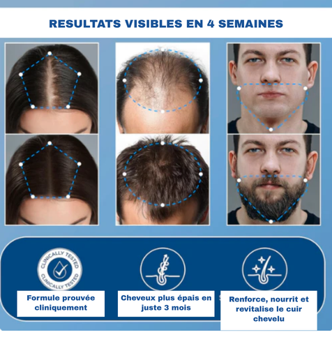 🌿 SÉRUM ROLL-ON CROISSANCE DE CHEVEUX – Homme&Femme🇺🇸 🇹🇬