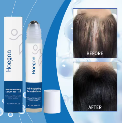 🌿 SÉRUM ROLL-ON CROISSANCE DE CHEVEUX – Homme&Femme🇺🇸 🇬🇦